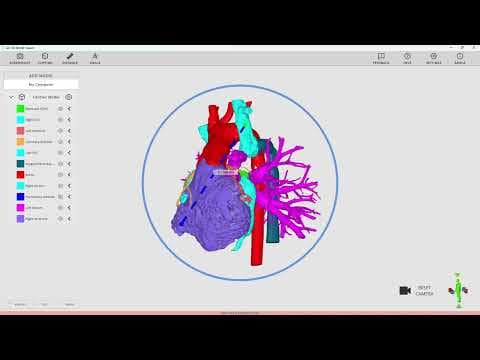 Rady Children's Arc Viewer (Lite)